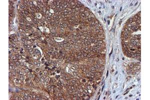 Image no. 12 for anti-Histidyl-tRNA Synthetase 2, Mitochondrial (Putative) (HARS2) antibody (ABIN1498584)