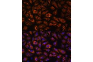 Immunofluorescence analysis of U-2 OS cells using VEGFR3/FLT4 Rabbit pAb (ABIN6130780, ABIN6140699, ABIN6140702 and ABIN6221242) at dilution of 1:100 (40x lens). (FLT4 抗体  (AA 1174-1363))