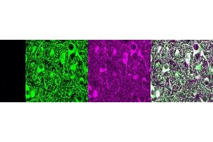 Immunohistochemistry (IHC) image for anti-Microtubule-Associated Protein 2 (MAP2) antibody (ABIN7456022)