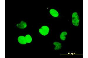 Immunofluorescence of monoclonal antibody to CTBP1 on HeLa cell. (CTBP1 抗体  (AA 1-429))