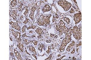 IHC analysis of RCC1 using anti-RCC1 antibody (ABIN7600022). (RCC1 抗体  (AA 14-421))