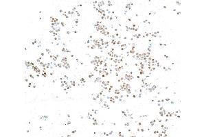 Immunocytochemistry (ICC) image for anti-N-Myc Proto-Oncogene Protein (MYCN) (AA 100-150) antibody (ABIN7795786) (Recombinant MYCN 抗体  (AA 100-150))