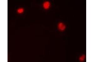Immunofluorescent analysis of Importin alpha 1 staining in HepG2 cells. (KPNA2 抗体)