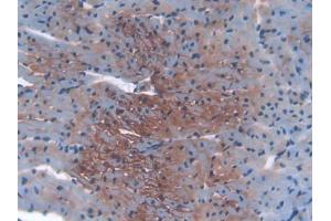 DAB staining on IHC-P; Samples: Mouse Heart Tissue (IGF2R 抗体  (AA 1148-1365))
