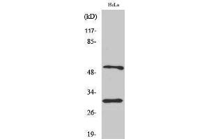 Western Blotting (WB) image for anti-Caspase 10 B/C (C-Term) antibody (ABIN3174181) (Caspase 10 B/C (C-Term) 抗体)