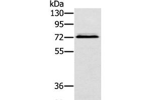 Western Blot analysis of Hepg2 cell using SSX2IP Polyclonal Antibody at dilution of 1:500 (SSX2IP 抗体)