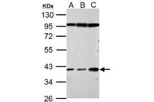 WB Image Haptoglobin antibody detects Haptoglobin protein by Western blot analysis. (Haptoglobin 抗体)