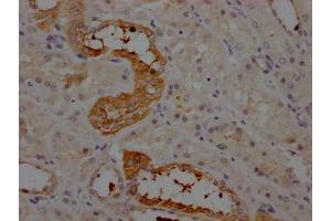 Immunohistochemistry (IHC) image for anti-Angiotensinogen (serpin Peptidase Inhibitor, Clade A, Member 8) (AGT) antibody (ABIN7127340)
