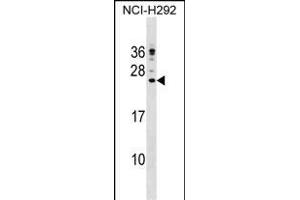 CP Antibody (C-term) (ABIN1536685 and ABIN2848635) western blot analysis in NCI- cell line lysates (35 μg/lane). (Cathelicidin 抗体  (C-Term))