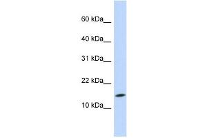 UBE2D3 antibody used at 1 ug/ml to detect target protein. (UBE2D3 抗体)