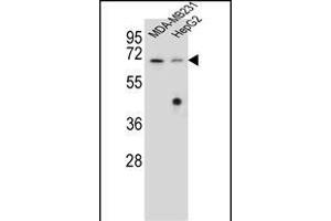 GLMN Antibody (C-term) (ABIN655986 and ABIN2845370) western blot analysis in MDA-M,HepG2 cell line lysates (35 μg/lane). (GLMN 抗体  (C-Term))