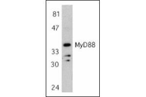 Western blot analysis of MyD88 in Jurkat whole cell lysate with this product at 1 μg/ml. (MYD88 抗体  (AA 233-248))
