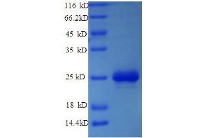 SDS-PAGE (SDS) image for Pvt-Associated Transcript (PAT) (AA 1-183), (full length) protein (His tag) (ABIN5710788)