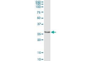 Immunoprecipitation (IP) image for anti-Pyrroline-5-Carboxylate Reductase 3 (PYCRL) (AA 32-131) antibody (ABIN566305)