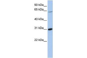 WB Suggested Anti-FRK  Antibody Titration: 0. (FRK 抗体  (Middle Region))