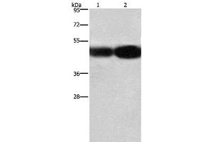 Western Blot analysis of A549 and 231 cell using BSG Polyclonal Antibody at dilution of 1:430 (CD147 抗体)