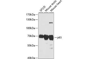 Western blot analysis of extracts of various cell lines, using p63 antibody (ABIN6133472, ABIN6149425, ABIN6149428 and ABIN6216786) at 1:3000 dilution. (p63 抗体  (AA 1-160))