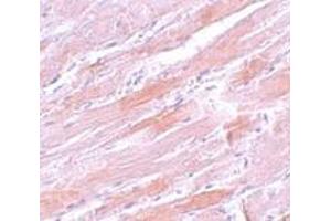 Immunohistochemistry (IHC) image for anti-Isocitrate Dehydrogenase 2 (NADP+), Mitochondrial (IDH2) (N-Term) antibody (ABIN1031407) (IDH2 抗体  (N-Term))