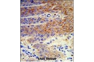 Formalin-fixed and paraffin-embedded human skin reacted with ATP12A Antibody (Center), which was peroxidase-conjugated to the secondary antibody, followed by DAB staining. (ATP12A 抗体  (AA 833-859))