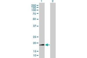 Western Blot analysis of RNF185 expression in transfected 293T cell line by RNF185 MaxPab polyclonal antibody. (RNF185 抗体  (AA 1-192))