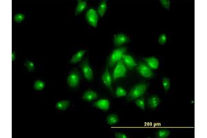 Immunofluorescence of monoclonal antibody to MGC16169 on HeLa cell. (TBCK 抗体  (AA 601-700))