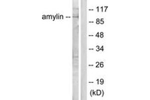 Western blot analysis of extracts from HeLa cells, treated with EGF 200ng/ml 30', using Amylin Antibody. (Amylin/DAP 抗体  (AA 1-50))