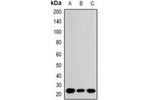 Western blot analysis of RhoGDI alpha expression in A549 (A), DLD (B), HepG2 (C) whole cell lysates. (ARHGDIA 抗体  (C-Term))