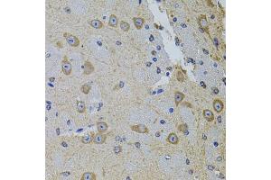 Immunohistochemistry of paraffin-embedded mouse brain using GM13125 antibody (ABIN6127294, ABIN6141172, ABIN6141175 and ABIN6216319) at dilution of 1:100 (40x lens). (Pramel15 抗体  (AA 1-477))