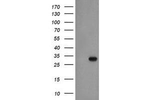 HEK293T cells were transfected with the pCMV6-ENTRY control (Left lane) or pCMV6-ENTRY EXOSC3 (Right lane) cDNA for 48 hrs and lysed. (EXOSC3 抗体)