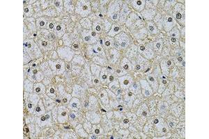Immunohistochemistry of paraffin-embedded Human liver damage using NRF1 Polyclonal Antibody at dilution of 1:100 (40x lens). (NRF1 抗体)