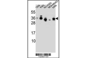 Western blot analysis in CEM,K562,NCI-H292,MDA-MB453,A549 cell line lysates (35ug/lane). (SSX4 抗体  (AA 63-91))