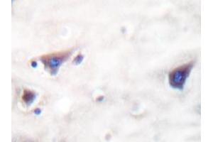 Immunohistochemistry analyzes of KSR antibody in paraffin-embedded human brain tissue. (KSR1 抗体)