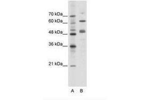 Image no. 1 for anti-GATA Binding Protein 4 (GATA4) (N-Term) antibody (ABIN6736111) (GATA4 抗体  (N-Term))