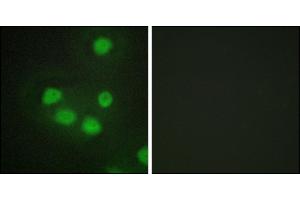 Immunofluorescence analysis of HepG2 cells, using SIX6 antibody. (SIX Homeobox 6 抗体)