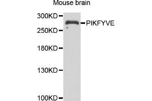 Western blot analysis of extracts of mouse brain, using PIKFYVE antibody. (PIKFYVE 抗体)