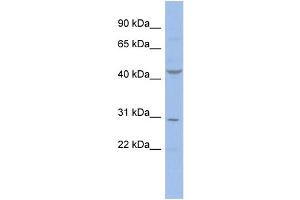 WB Suggested Anti-CCNE2  Antibody Titration: 0. (Cyclin E2 抗体  (N-Term))