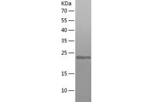 Western Blotting (WB) image for ADP-Ribosylation Factor 6 (ARF6) (AA 1-175) protein (His tag) (ABIN7283465) (ARF6 Protein (AA 1-175) (His tag))