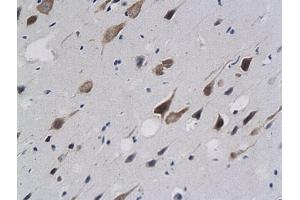 Formalin-fixed and paraffin embedded rat brain labeled with anti-Calponin 1/COLP Polyclonal Antibody (ABIN724820), Unconjugated followed by conjugation to the secondary antibody and DAB staining (CNN1 抗体  (AA 201-297))