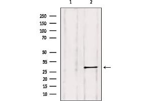 Western blot analysis of extracts from HepG2, using Rab 11B Antibody. (RAB11B 抗体  (C-Term))