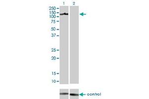 Western blot analysis of AXL over-expressed 293 cell line, cotransfected with AXL Validated Chimera RNAi (Lane 2) or non-transfected control (Lane 1). (AXL 抗体  (AA 30-140))