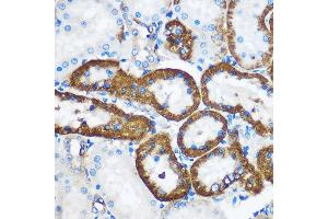 Immunohistochemistry (IHC) image for anti-Phosphatidylethanolamine-Binding Protein 4 (PEBP4) antibody (ABIN7269280)