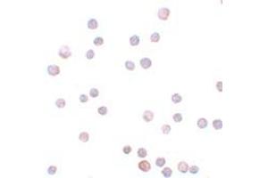 Immunohistochemistry (IHC) image for anti-Zinc Finger E-Box Binding Homeobox 1 (ZEB1) (Middle Region) antibody (ABIN1031173) (ZEB1 抗体  (Middle Region))