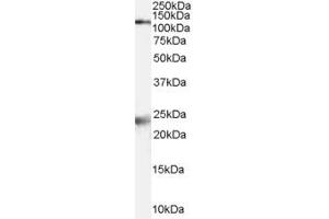 Western Blotting (WB) image for anti-Glutamate Receptor, Ionotropic, N-Methyl D-Aspartate 1 (GRIN1) (Internal Region) antibody (ABIN2466016) (GRIN1/NMDAR1 抗体  (Internal Region))