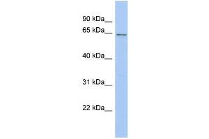 WB Suggested Anti-SMARCD2 Antibody Titration: 0. (SMARCD2 抗体  (Middle Region))