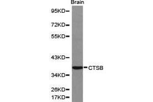 Western Blotting (WB) image for anti-Cathepsin B (CTSB) antibody (ABIN1872095) (Cathepsin B 抗体)
