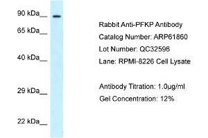 Western Blotting (WB) image for anti-phosphofructokinase, Platelet (PFKP) (C-Term) antibody (ABIN2788927) (PFKP 抗体  (C-Term))
