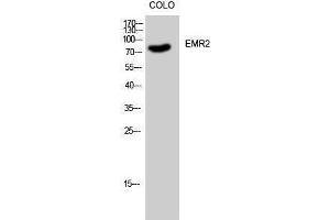 Western Blotting (WB) image for anti-Egf-Like Module Containing, Mucin-Like, Hormone Receptor-Like 2 (EMR2) (C-Term) antibody (ABIN3184475) (EMR2 抗体  (C-Term))