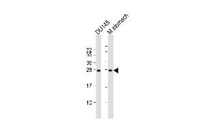 Lane 1: DU145 Cell lysates, Lane 2: mouse stomach Cell lysates, probed with RAB27B (1596CT245. (RAB27B 抗体)
