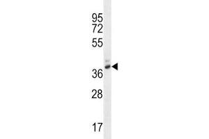 PGA4 antibody western blot analysis in WiDr lysate. (PGA4 抗体  (AA 353-381))