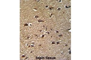 Immunohistochemistry (IHC) image for anti-Glycine C-Acetyltransferase (GCAT) antibody (ABIN3003250) (GCAT 抗体)